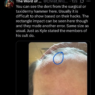 Christ_Will_Iam's profile picture. ⚡️I am Satoshi Nakamoto⚡️

I am being silenced, framed, stolen from, mutilated, and slowly killed by Trump and his cult… maga is m666.