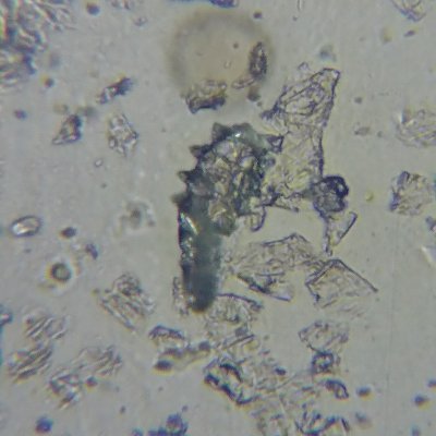 sakura155078's profile picture. I post about my parasitic nematode infection.
My profile photo is a cute face mite. 
But I can't stand nematodes.

線虫感染症に関して個人の勝手な記録です
プロフ画像は顔ダニです
顔ダニは可愛いが線虫は無理