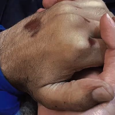 ayoosha2551851's profile picture. Ayaat, 29, Gaza 💔 | Widow, 4 months pregnant | Lost husband & baby in airstrike | Fighting to keep her daughter & sick parents alive 🍼🙏