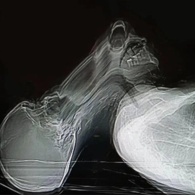 misrecognitions's profile picture. LPCA psychotherapist | PhD religious studies | psychoanalysis, critical theory, etc.