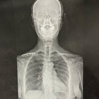 rip4tears's profile picture. Japanese TEISCO guitar user. 《band》the atmos., D.U.G.P.O.D, BizarreLoveTriangle, #ポルノチャンネル企画部 https://t.co/JL5c4Q9eMe