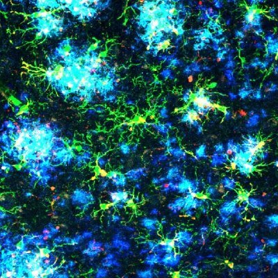 MonsonegoLab's profile picture. Immune regulation, autoimmunity, aging, neurodegenerative diseases, chronic stress, glial biology, T cell therapy