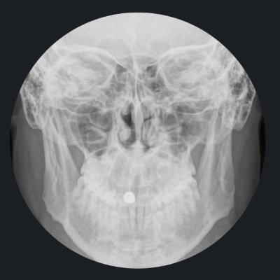 DrJN_SportsMed's profile picture. Difficult stuff.