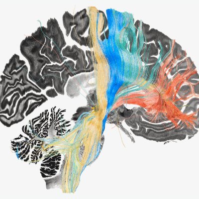 comp16676935420's profile picture. Comp neuro researcher  🧠
Brains → models → insights
Currently: Trying to model the brain
Open DMs · let’s geek out