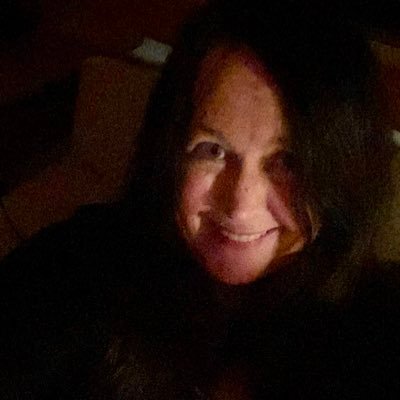 karenlubell's profile picture. ME/CFS is a connective tissue weakening caused/worsened by a virus. This can lead to Craniocervical Instability, Venous Compressions, CSF leaks and more.