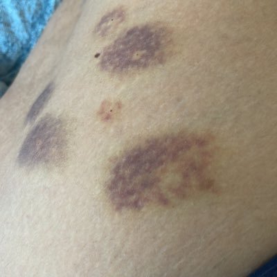 SokolovicEx's profile picture. The Only Granddaughter of The Grandpa Ivan. ONE of The Former Yugoslavian President Josip Broz Tito Military Defence Force’s Main Guys.The Grandpa Vejsil’s too.