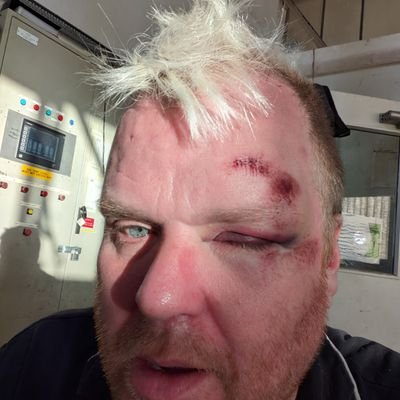 mrfonch's profile picture. I used to be quite pretty ,
now i'm not .
I used to be Nick Cotton ,
Now i'm Dot