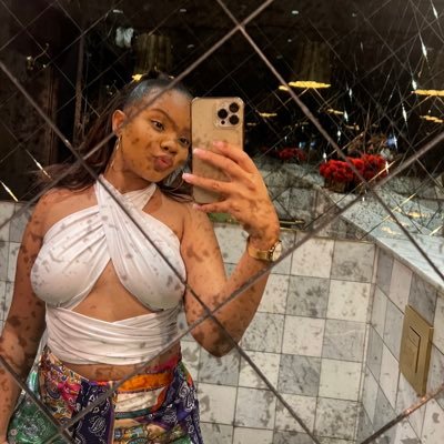 PaballoSaid's profile picture. Strangers think I'm quiet. My Friends think I'm outgoing. My Bestfriend thinks I'm insane | freckle face 💫✨