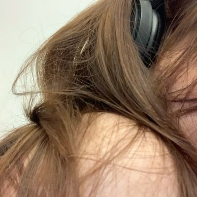 glossierloser's profile picture. 