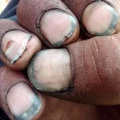 Aerolkgatla1's profile picture. Betway is my everyday job.