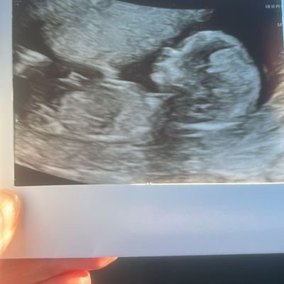 leestevensmith's profile picture. Derby County FC and Derry City FC