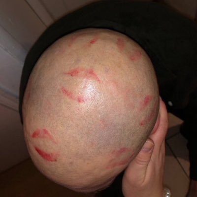 avfcfern's profile picture. 24 | avfc | EK4