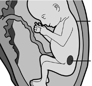 Prenatal pharma exposures--widespread in 1950s-70s--damaged vulnerable fetal germ cell epigenetics, causing abnormal neurodevelopment in the third gen.