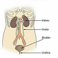 UMiamiUrology (@umiamiurology) 's Twitter Profile