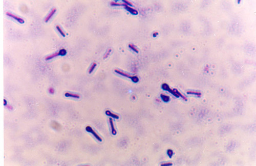 RddRichard's profile picture. Internet addict, lover of science, medicine, psychology, evolution, universe, loves watching TED videos, loves meeting new people and learning about new things!