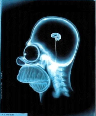 Hay dos tipos de personas: los que tienen alzheimer y los que tienen alzheimer.. | Devuelvo el follow. RT