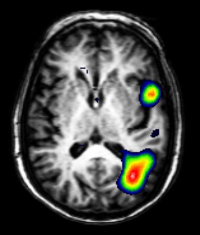 Current Trends in Nuclear Medicine and Molecular Imaging