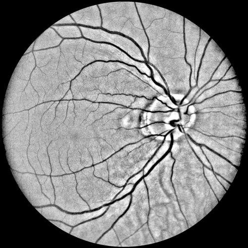 http://t.co/b89lod0ovs @Annidis_Corp I build the Annidis RHA in Ottawa Canada. The RHA™ instrument is a multi-spectral imaging digital ophthalmoscope.