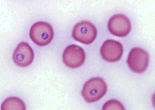 Smallest known bacterium // Lack a cell wall // Synergic role in causing Shipping fever in cattle