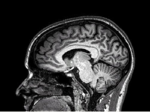 sparker1963's profile picture. Yes that is my brain. Looking for descendants of Samuel Parker & Bathsheba Cheeseman of NJ for genealogical purposes.