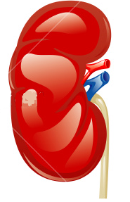 Creator of http://t.co/ETXrxsMcNH - everything about creatinine clearance and kidney function problems