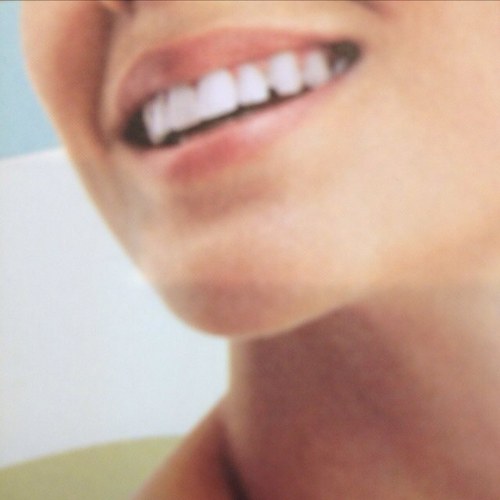 Stand out from the crowd with a Smile that Sparkles!! Laser Teeth Whitening @ Beauty Works Salon 01273 304255