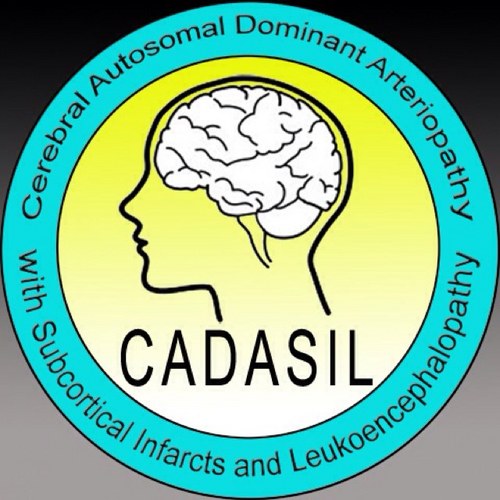 cerebral autosomal dominant arteriopathy with subcortical infarcts and leukoencephalopathy
