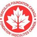 Vasculitis_Canada (@vasculitis_cnd) Twitter profile photo Vasculitis_Canada (@vasculitis_cnd) Twitter profile photo
