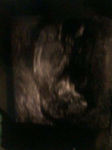 lilmisjen's profile picture. mum with 6 gawjus kiddies eldest 19 youngest 4months stressed in all areas of my life just know i love my babies my fam friends n simples sooooo much xxxx