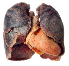 ThanesLungs's profile picture. *struggles to take in oxygen*