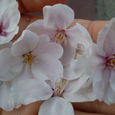 資子 今日学んだこと 赤ちゃんの頭蓋骨は応形機能があり 産道を通過しながら骨を重ねて出てくる だから産瘤 骨膜と皮膚の間の ぶよぶよした水 や頭血腫 骨膜と骨の間にできる縫合線を超えない血の固まり ができる 産瘤は24 36時間で消失