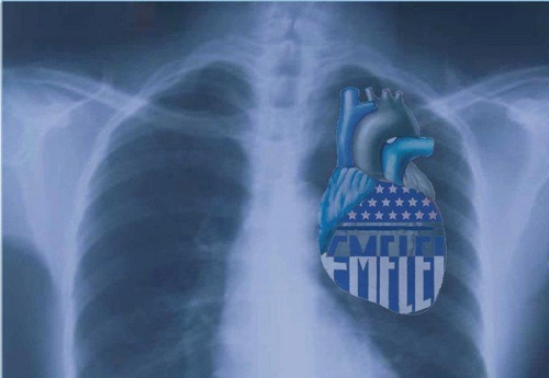 Azul de corazon