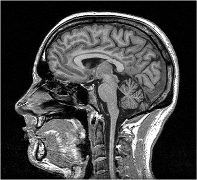 AuntieParallel's profile picture. All things MRI with a higher energy level.