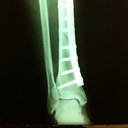 Juan Manuel Escoto - @drescototrauma - Twitter