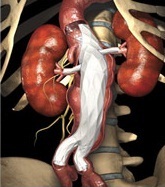 Endovascular Aortic Aneurysm Repair at Surgical Care Associates