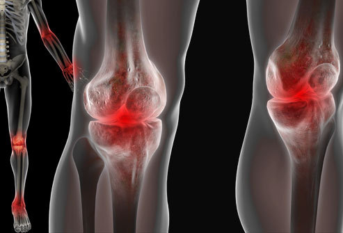 Rheumatologist MD, General practioner, keen interest in all updates in rheumatology and medicine. +230 59076469