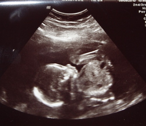 UnbornAnthony_C's profile picture. Inside @AliPieCullen Tummy