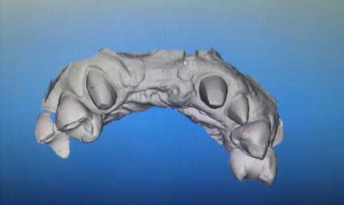 #tandarts#mondzorgcentrum Etten-Leur#modern#kinderbehandeling#bijscholing#kwaliteit#Hovius#itero#invisalign