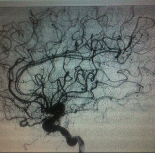 AlephCas's profile picture. UNAM - Ortopedia//. Endoprotesis y Ortobiologicos, Porque no Saber y Sonreir cada dia un poco mas...