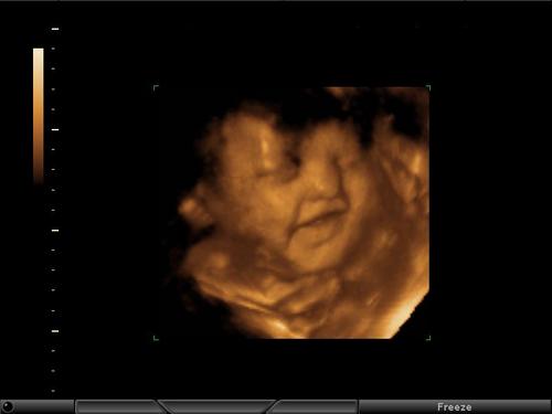 We are a family owned and operated business in Fort Lauderdale.  We provide the amazing experience of 3D/4D Ultrasounds to all of South Florida!