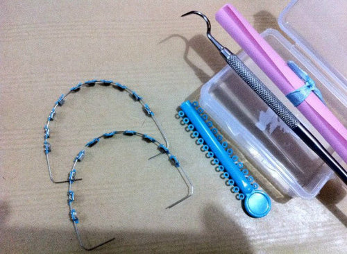 behelclub's profile picture. Gudang behel permanen & lepas pasang 085761424125