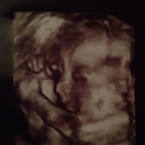 laurra_bethh's profile picture. Imperfection Is Beauty.
Madness Is Genius.
And It Is Better To Be
Absolutely Rediculous 
Than
Absolutely Boring.