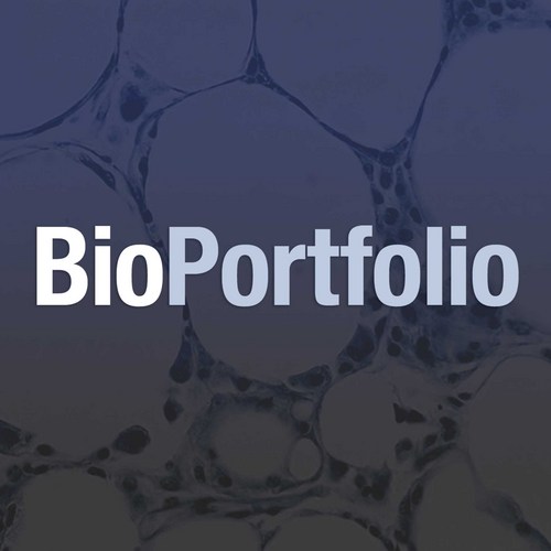 Track the latest #hormone news, research, clinical trials, companies and reports. Continuously updated from 500+ news, research publications. BioPortfolio