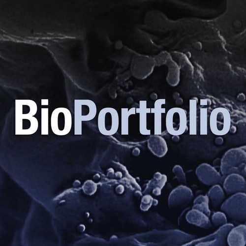 Track the latest #Epigenetics news, research, clinical trials, companies and reports. Continuously updated from 500+ news, research publications. BioPortfolio