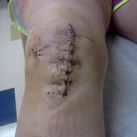 ACL Problems (@acl_problems) 's Twitter Profile