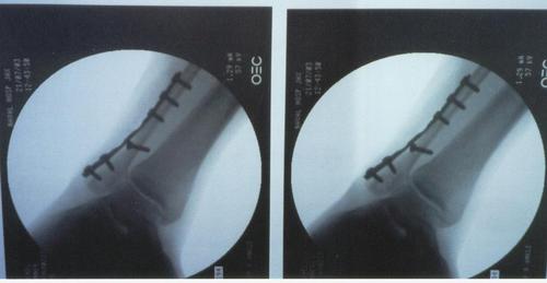 XAthleticism's profile picture. Love the extreme side of life.