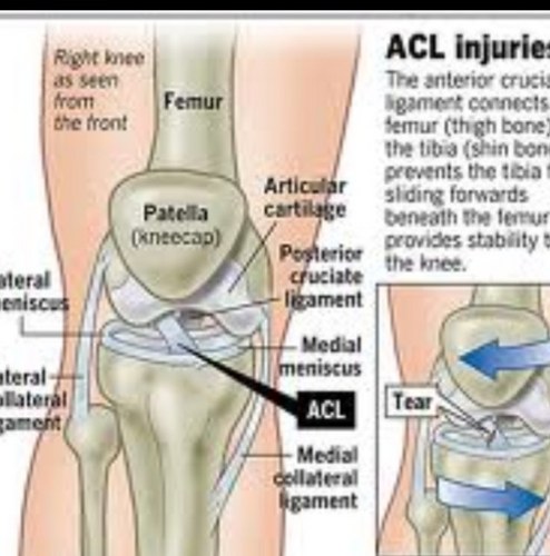 ACL_life's profile picture. True occurances in your life all because you tore your acl... From surgery, to PT, to that first step back onto the field. https://t.co/Gmmffo5bGe