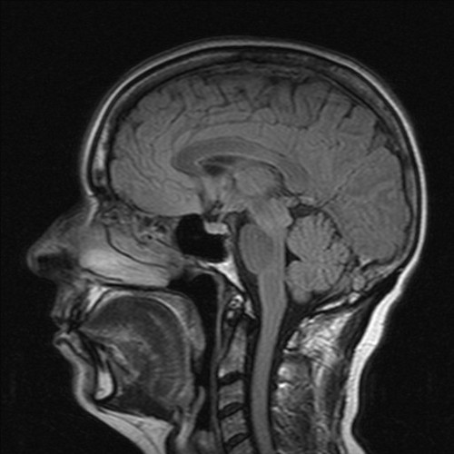An update on neurology training resources in the West Midlands or online.