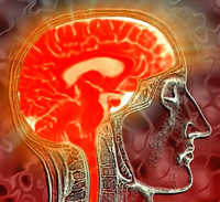 http://t.co/tXi53QdVhD provides information on Multiple Sclerosis, Symptoms, and Treatment.