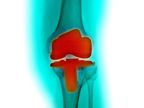 Integrates Orthopaedic and related medical knowledge and courses from around the world
